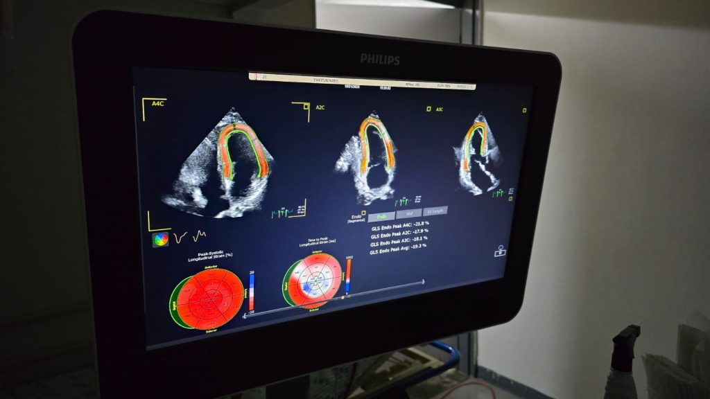 Novo ecocardiograma garante diagnósticos mais precisos, inclusive para prematuros, no HRMS – Agência de Noticias do Governo de Mato Grosso do Sul