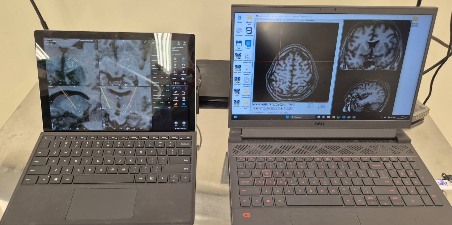 Hospital Regional de Três Lagoas realiza 1ª cirurgia cerebral pelo SUS para tratar Parkinson em MS